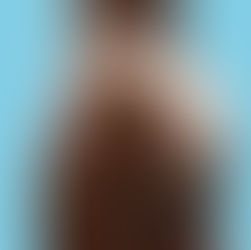 HOW LONG DOES A BBL LAST?