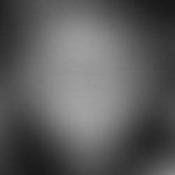 ከነጭ ቆዳዎች በስተጀርባ ፡ የለምጽ እጣ በኢትዮጵያ