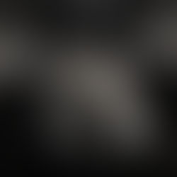 የጭንቀት ህመም ጉዳይስ?