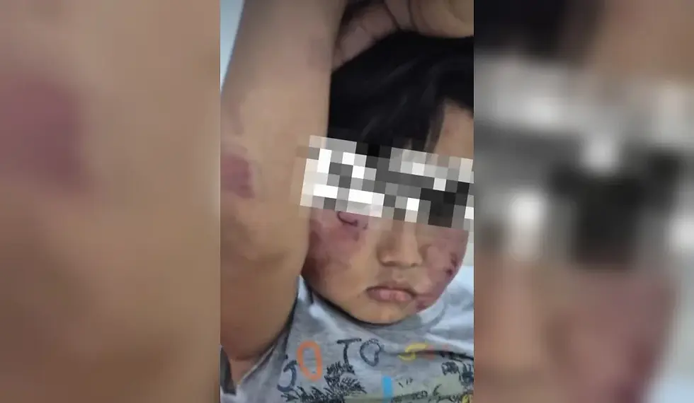 Criança de 2 anos fica com ferimentos no rosto dentro de creche em Belém; PC investiga