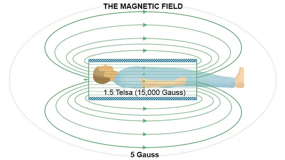 Магнитное поле МРТ