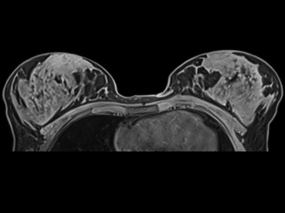 МРТ изображение
Siemens
MAGNETOM Skyra