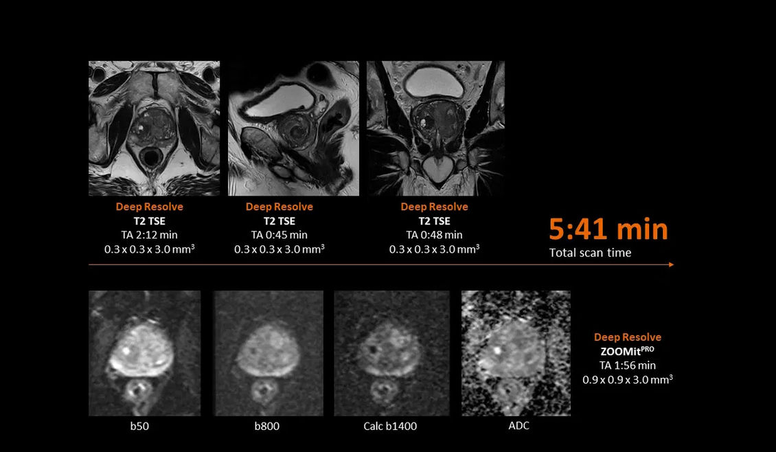 Аппарат МРТ Siemens MAGNETOM Flow клинические изображения
