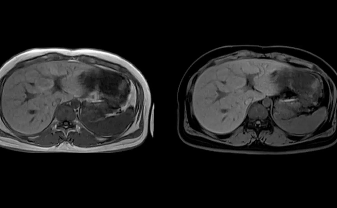 МРТ изображение
Siemens
MAGNETOM Free.Start