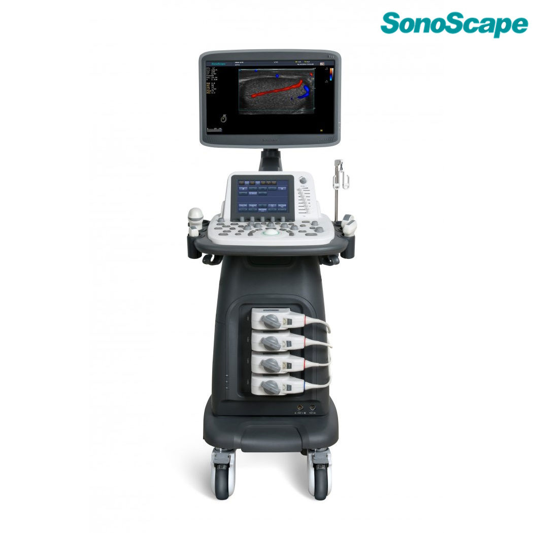 Аппарат УЗИ SonoScape S20