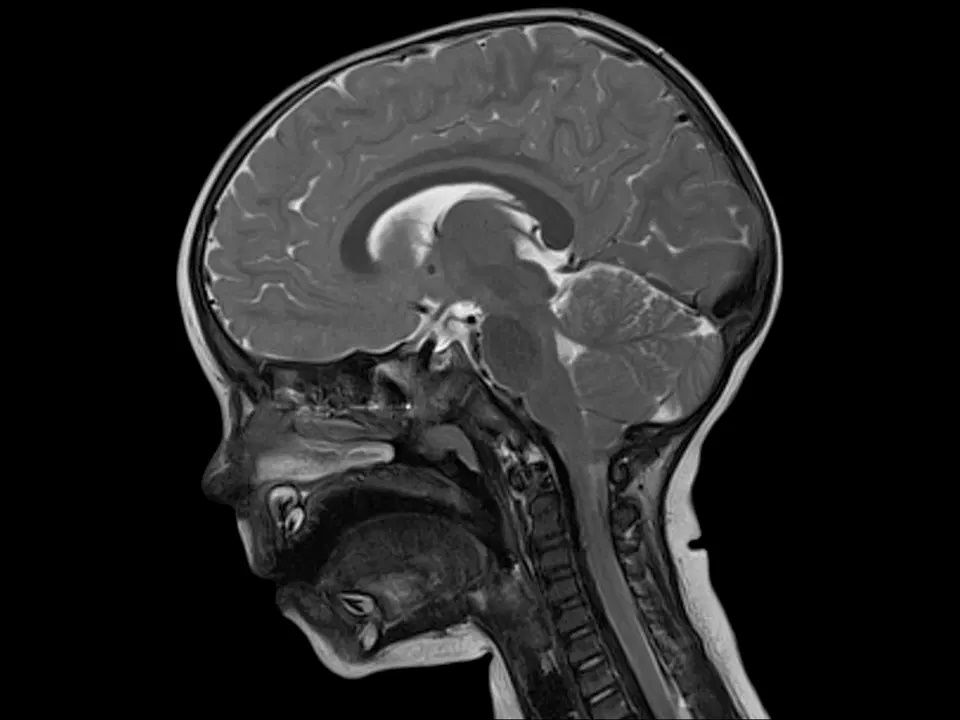 МРТ изображение
Siemens
MAGNETOM Skyra