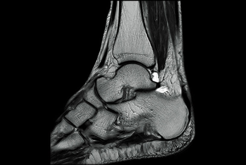 Аппарат МРТ Fujifilm ECHELON Smart клиническое изображение