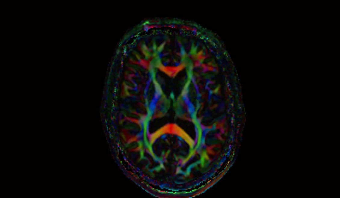 Siemens MAGNETOM Cima.X клиническое изображение