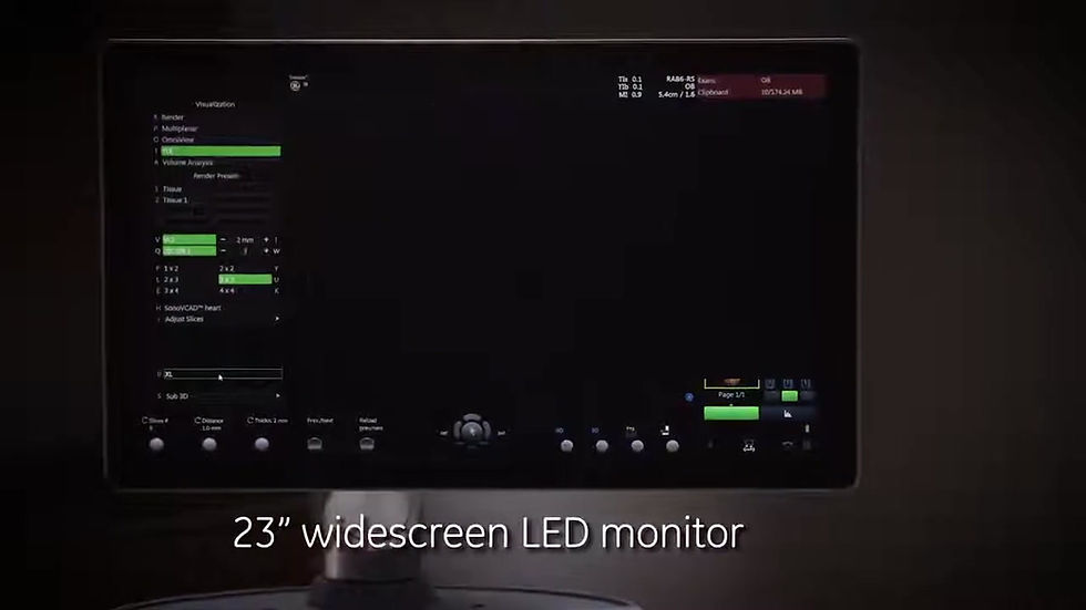 Миниатюра: Ультразвуковой аппарат GE Voluson S8