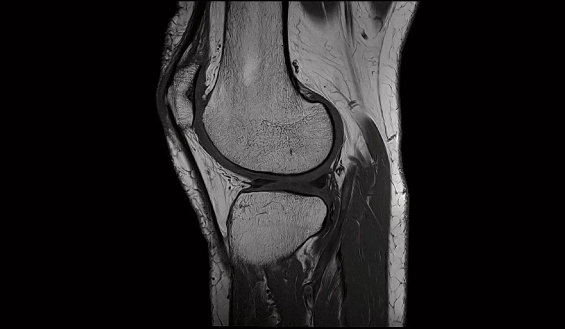 Аппарат МРТ Siemens MAGNETOM Cima.X клиническое изображение