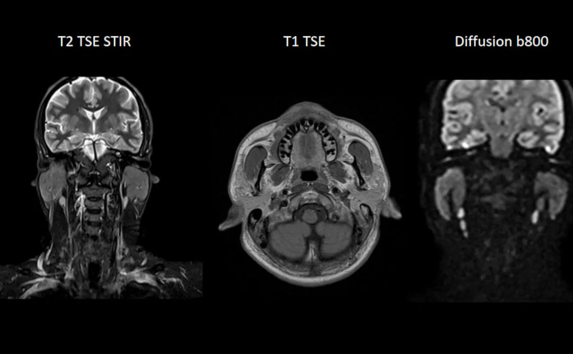 МРТ изображение
Siemens
MAGNETOM Free.Start