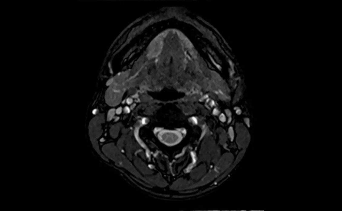 МРТ изображение
Siemens
MAGNETOM Free.Start