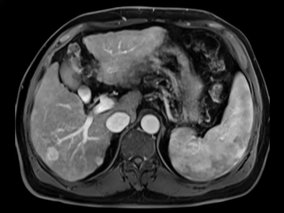 МРТ изображение
Siemens
MAGNETOM Skyra