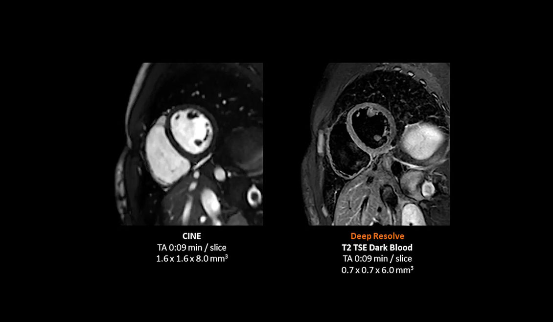 Аппарат МРТ Siemens MAGNETOM Flow клинические изображения