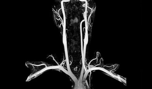 Fujifilm OASIS Velocity