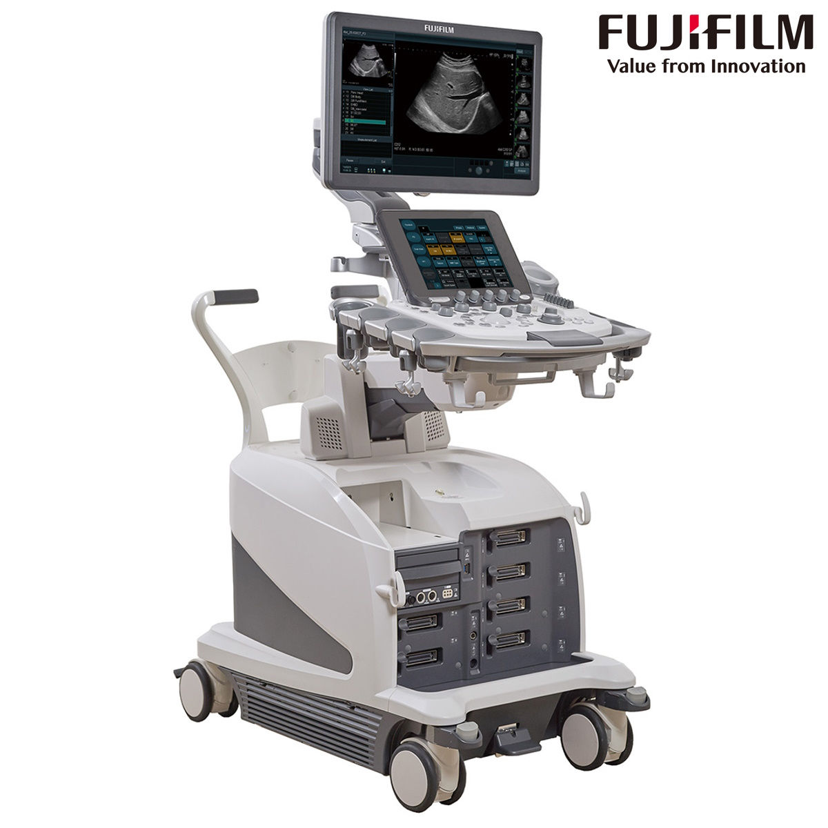 Аппарат УЗИ Fujifilm Arietta 750