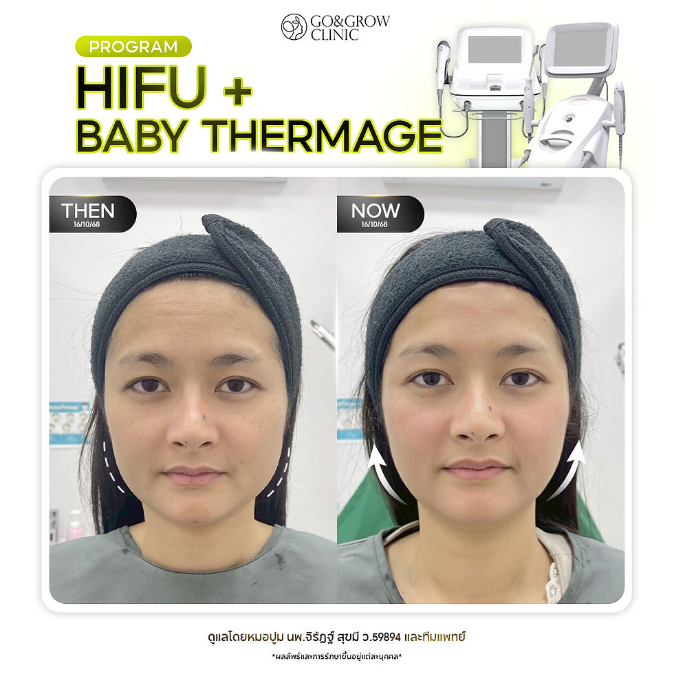 Review of HIFU + Baby 8.jpg