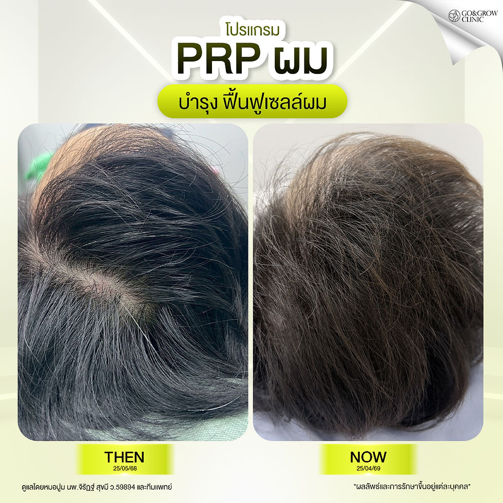 prp hair.jpg