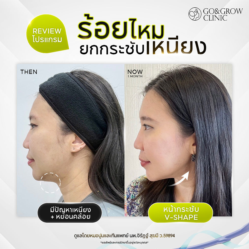 Thread lifting by P'Toy.jpg