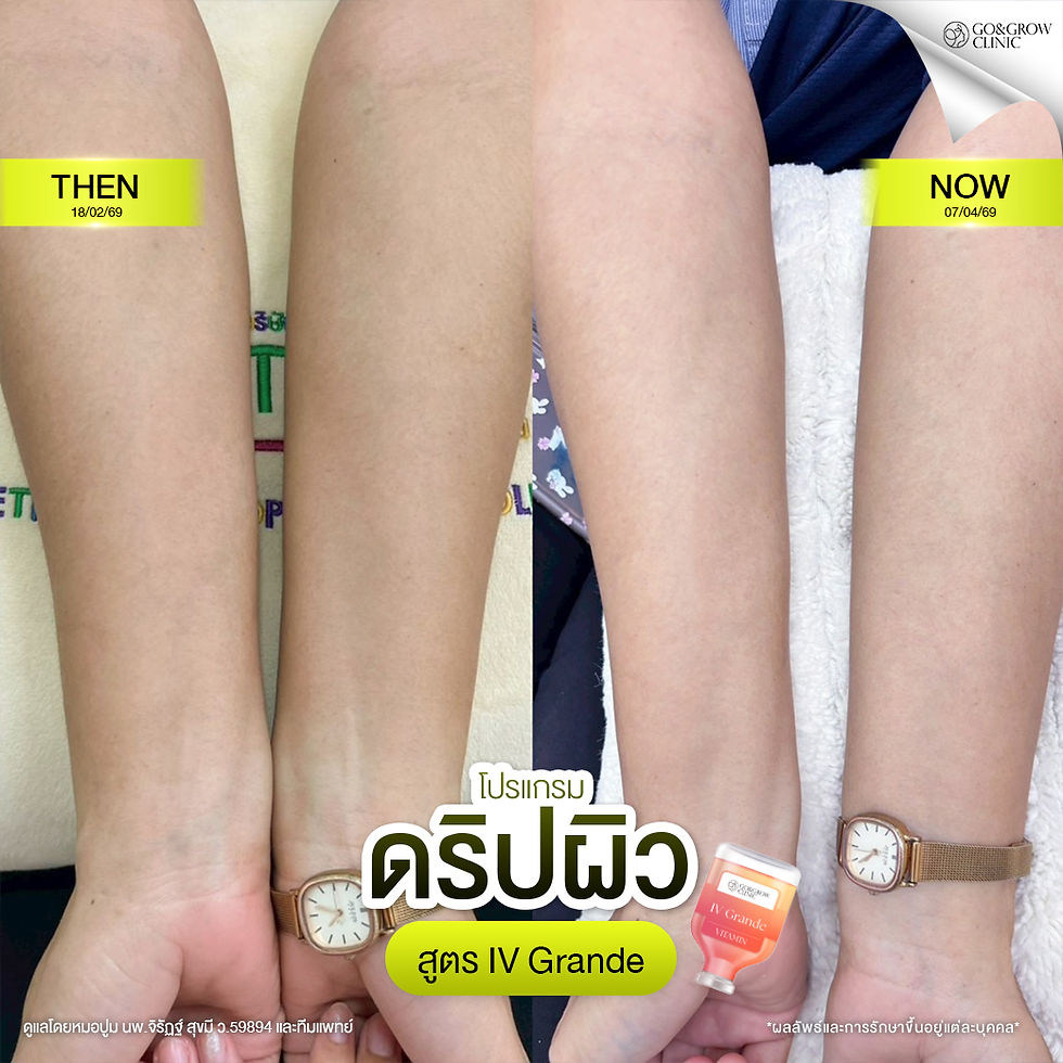 รีวิวดริปผิว6.jpg
