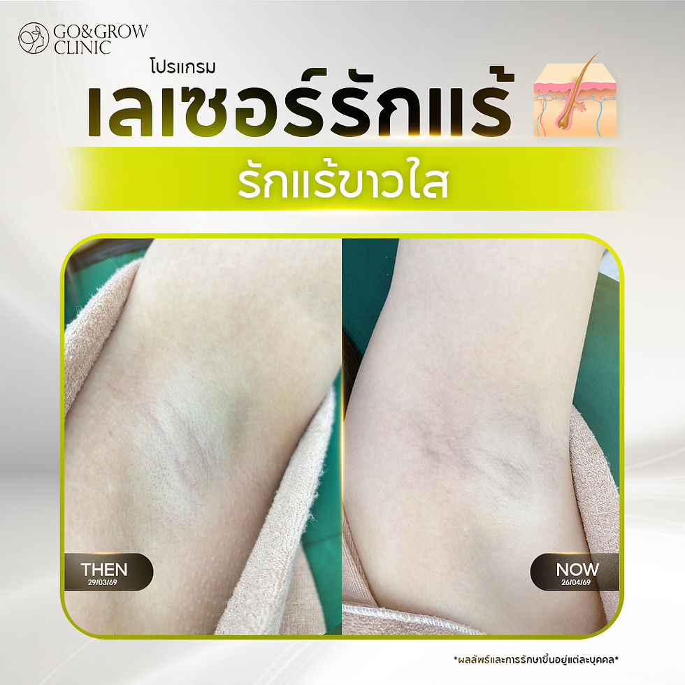 รีวิวรักแร้15.jpg