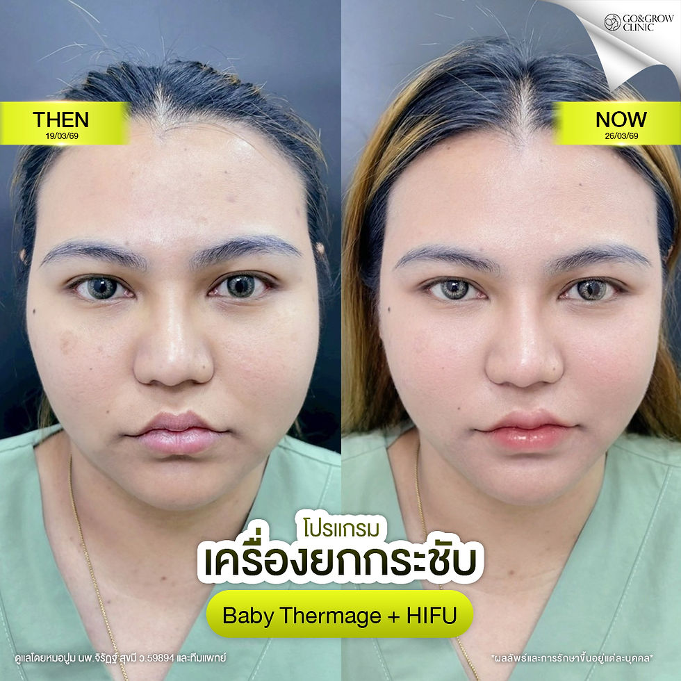 รีวิวไฮฟู่+เบบี้10.jpg