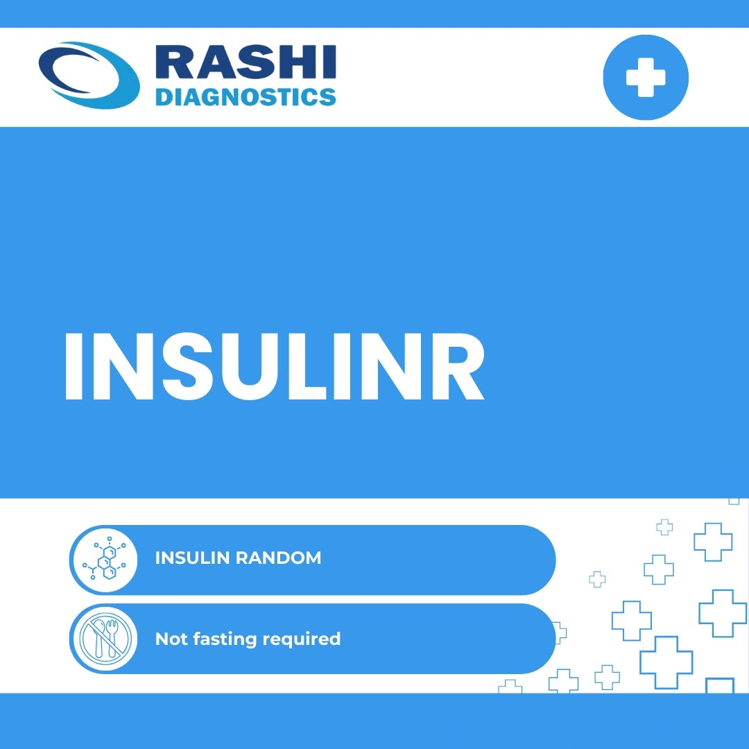 INSULIN RANDOM