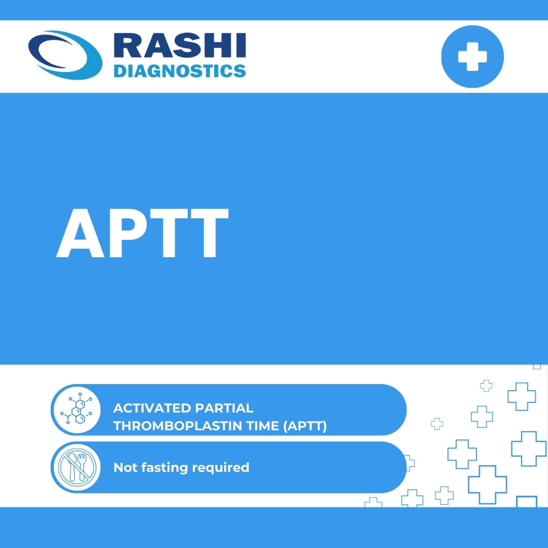 ACTIVATED PARTIAL THROMBOPLASTIN TIME (APTT)
