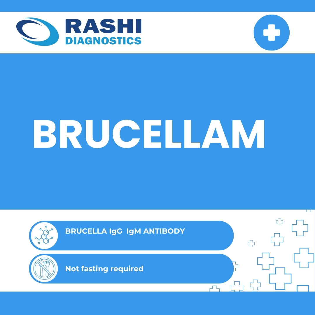 BRUCELLA IgG IgM ANTIBODY