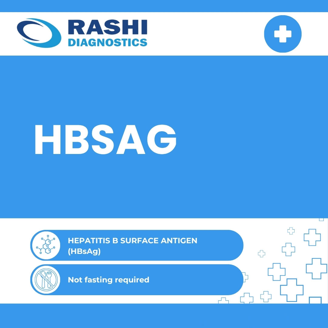 HEPATITIS B SURFACE ANTIGEN (HBsAg)