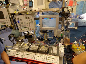 Inside the Life of a Cardiovascular Perfusionist