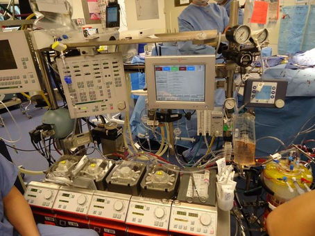 Inside the Life of a Cardiovascular Perfusionist