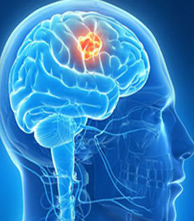 Best Spine Surgeon in Bangalore Offer Complete Treatment for Nervous System!