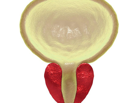 Tampa, Florida, suggests Prostatic Massage 