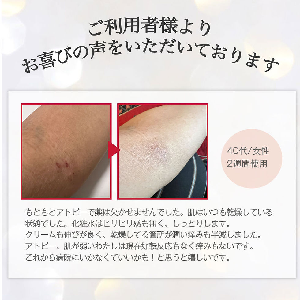 サムネイル： ナッツボヌール3点セット