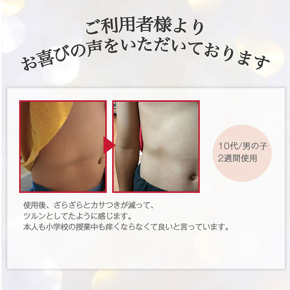 サムネイル： ナッツボヌール3点セット