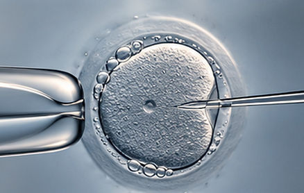 precision-ivf-icsi.jpg