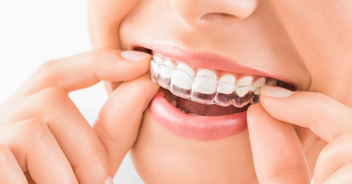 invisalign-dentist.jpg