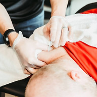 Dry Needling
