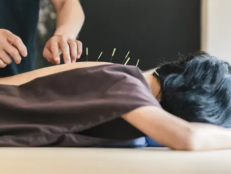 How Acupuncture Can Help After a Car Accident: A Comprehensive Guide
