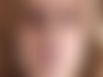 Skin Boosters Injection Near Me
