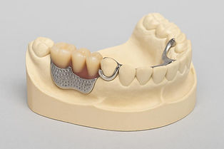 removal partial dentures.jpg