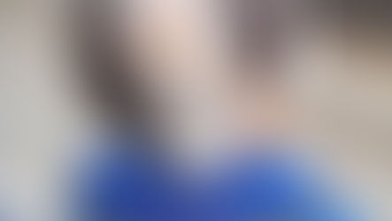 Akibat Lemparan Kayu, Kepala Bocah SDN Jombang Robek