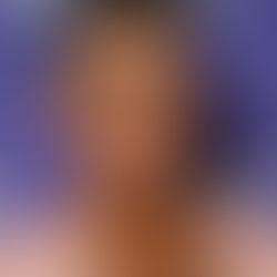 Qué es el síndrome de Tourette, la enfermedad que padece Robbie Williams