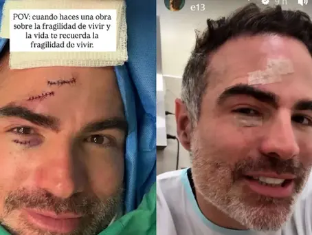 Roberto Manrique sufrió un accidente en el preestreno de su obra de teatro