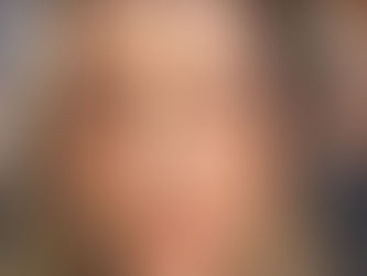 Mulher ganha mais de R$ 12 mil por dia catando piolho nos EUA