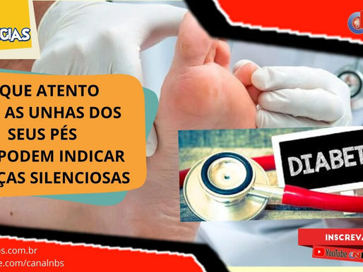 Cuidado. Alterações nas unhas dos pés podem indicar 'doença silenciosa'