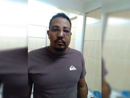 Cliente discordou de leitura de tarô e espancou a cartomante no DF