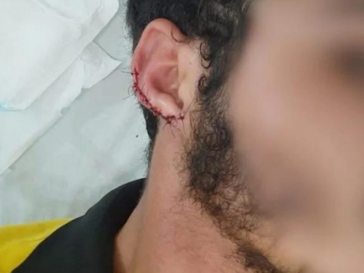 Vídeo: Um funcionário de uma lanchonete tem sua orelha mordida e arrancada por cliente