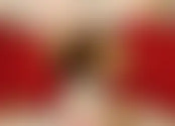 Gêmeas siamesas são separadas após cirurgia de 25 horas, em São Paulo